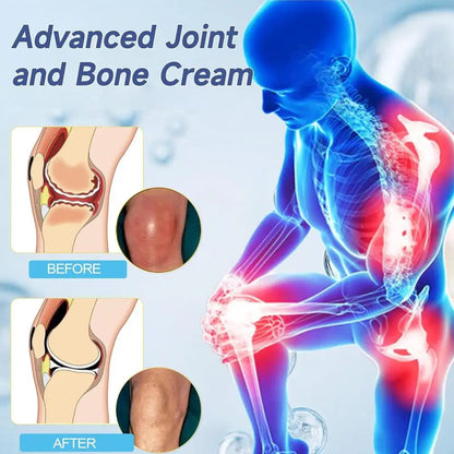 50g Hyaluronic Acid Joint Repair Cream for Pain Relief