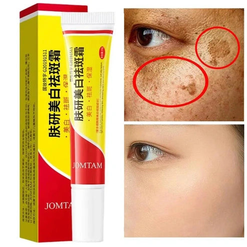 Aaponminimarket Niacinamide Brightening Cream