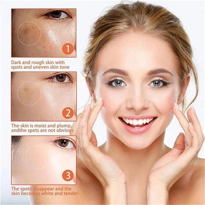 Aaponminimarket Niacinamide Brightening Cream