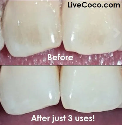 Aaponminimarket Teeth Cleaning Powder with Aloe Vera