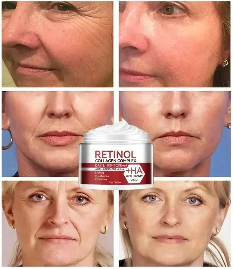 Anti Aging Face Cream for Fine Lines
