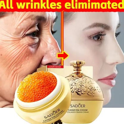 Aapon Mini Market Ltd Caviar Anti-Wrinkle Face Cream