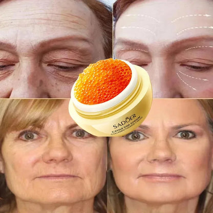 Aapon Mini Market Ltd Caviar Anti-Wrinkle Face Cream