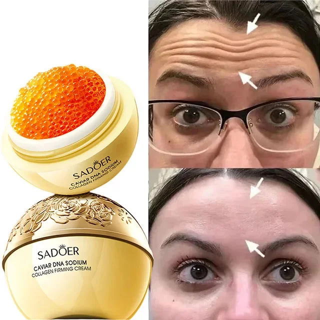 Aapon Mini Market Ltd Caviar Anti-Wrinkle Face Cream