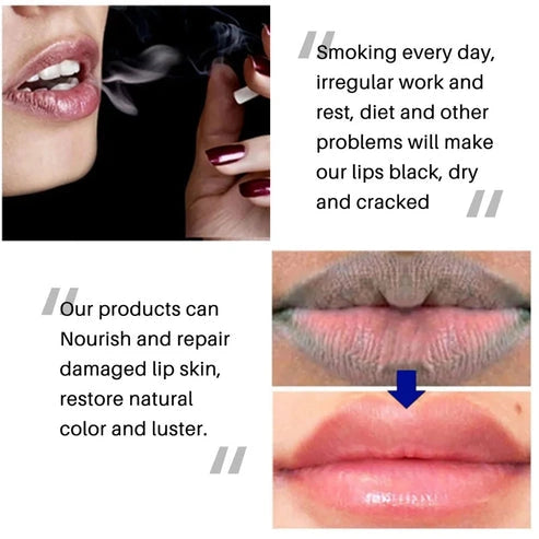 Aaponminimarket Dark Lip Repair Balm