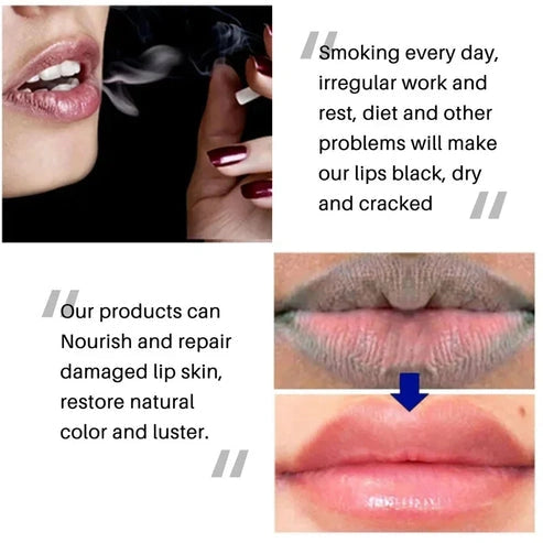 Dark Spot Remover & Moisturizing Balm