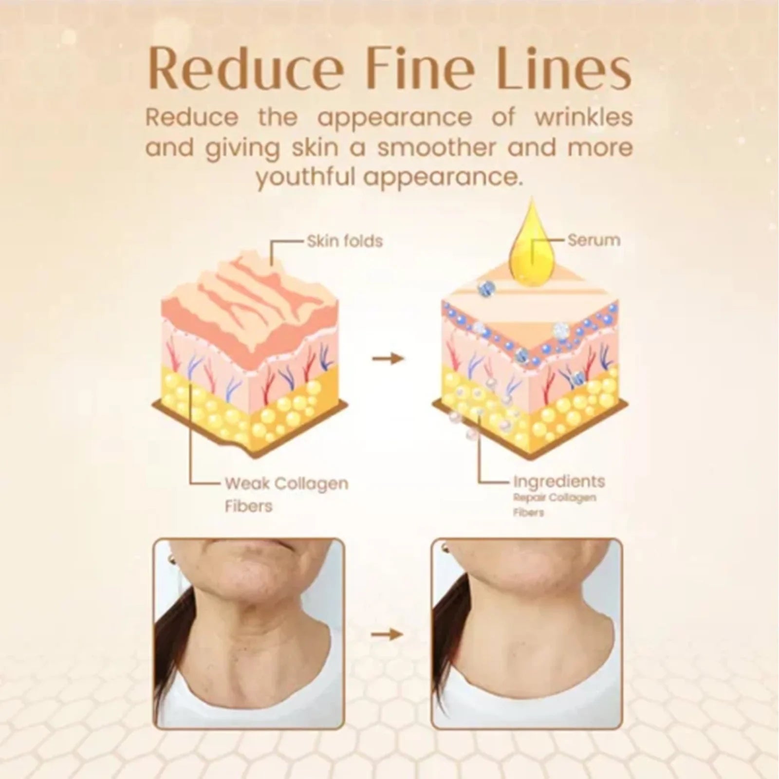 Aapon Mini Market Ltd EELHOE Anti-Aging Bee Venom Serum