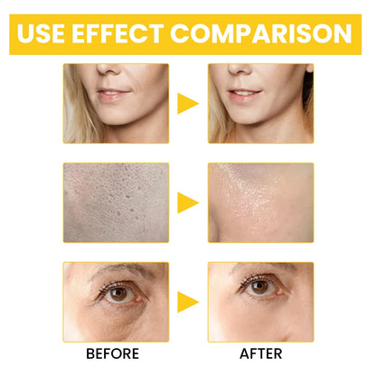 Aapon Mini Market Ltd EELHOE Anti-Aging Serum