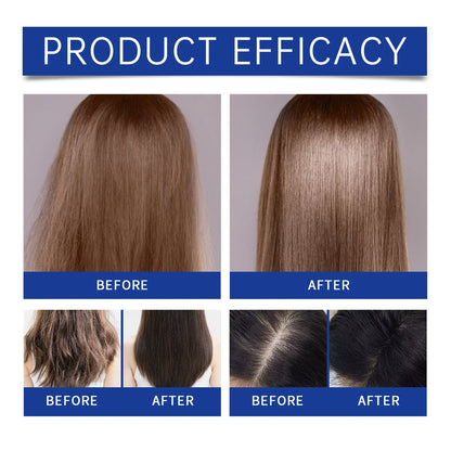 Aapon Mini Market Ltd - EELHOE Hyaluronic Acid Care & Growth Kit