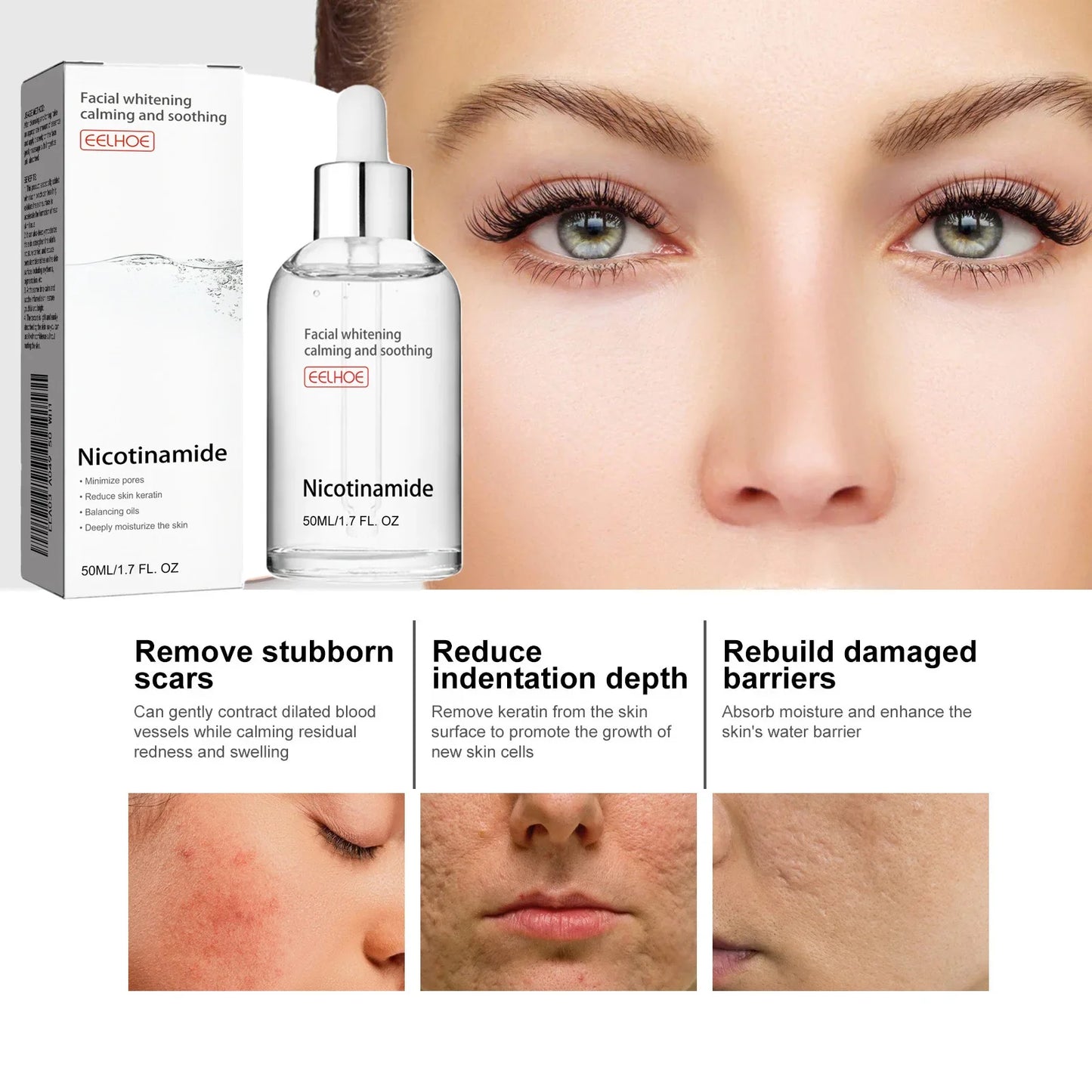 Aapon Mini Market Ltd EELHOE Nicotinamide Serum