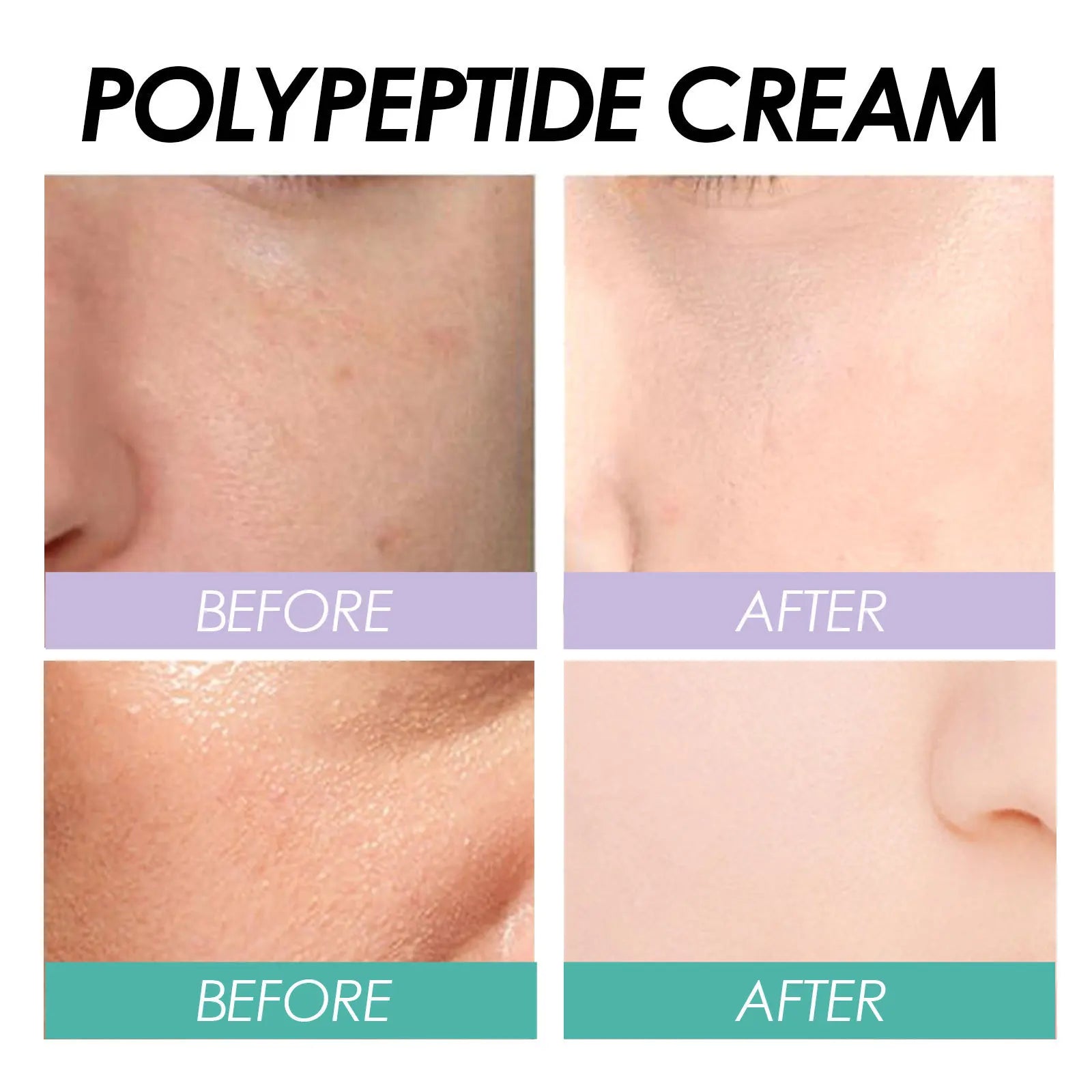 Aapon Mini Market Ltd EELHOE Polypeptide Anti-Aging Moisturizer