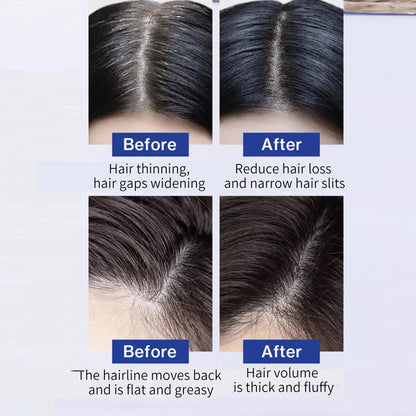FEG Hair Growth Spray