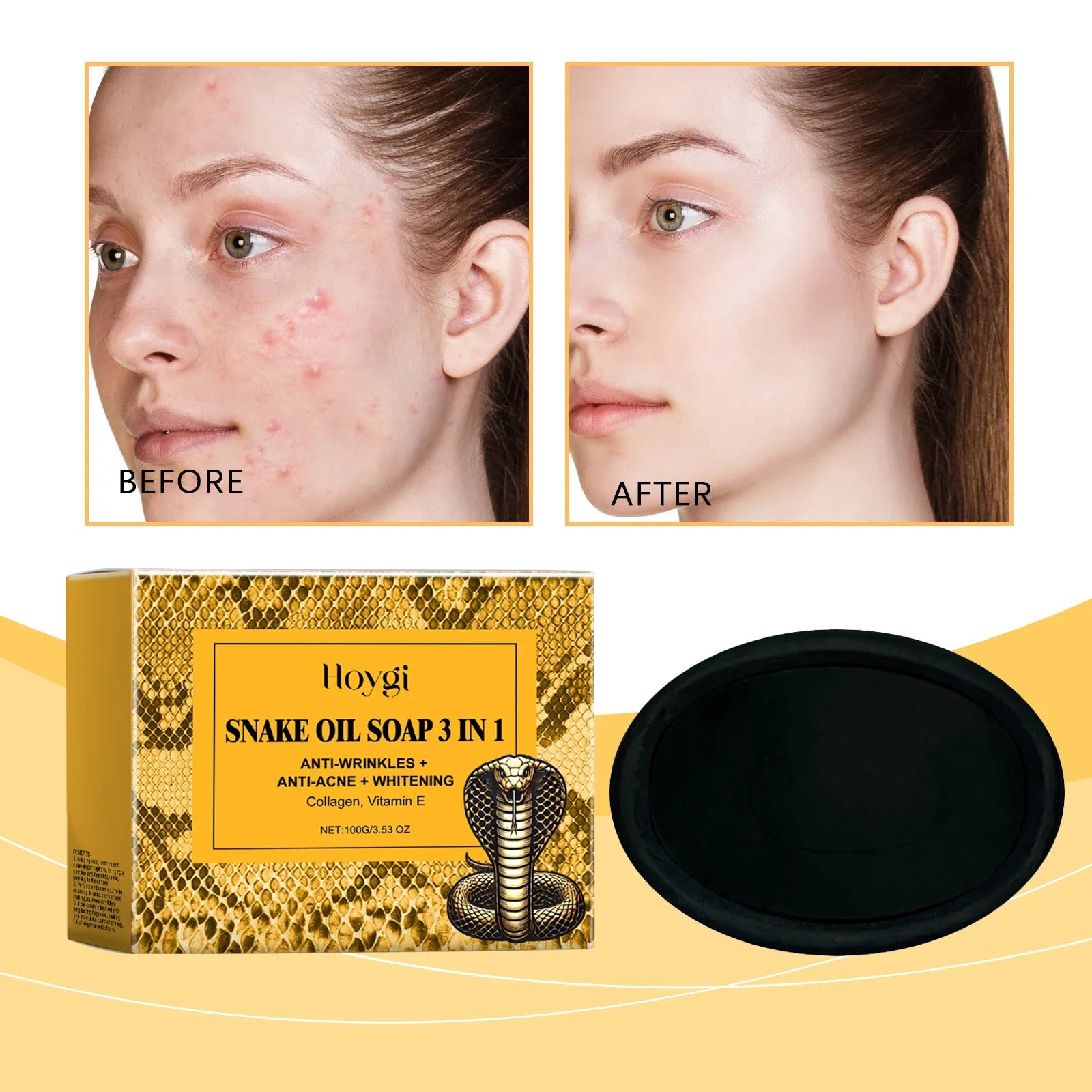 Aapon Mini Market Ltd Hoygi Snake Oil Facial Cleansing Soap 100g