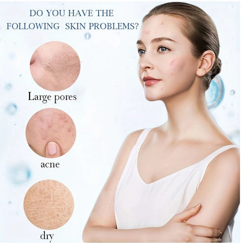 Aaponminimarket Water Ice Levin Hyaluronic Acid Cream