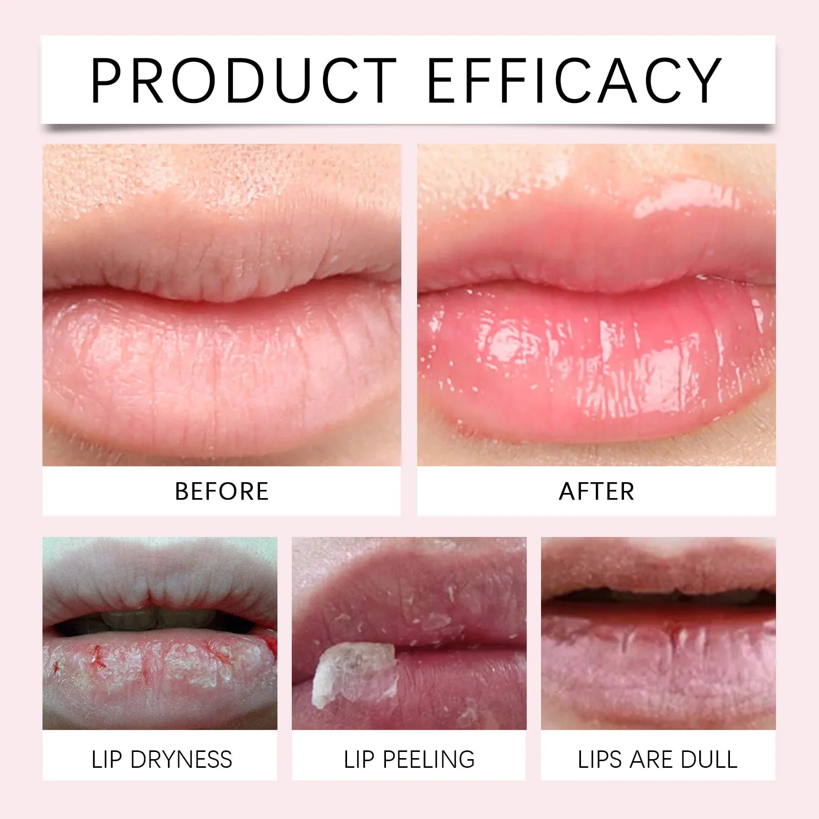 Aapon Mini Market Ltd Lip Oil for Nourishment