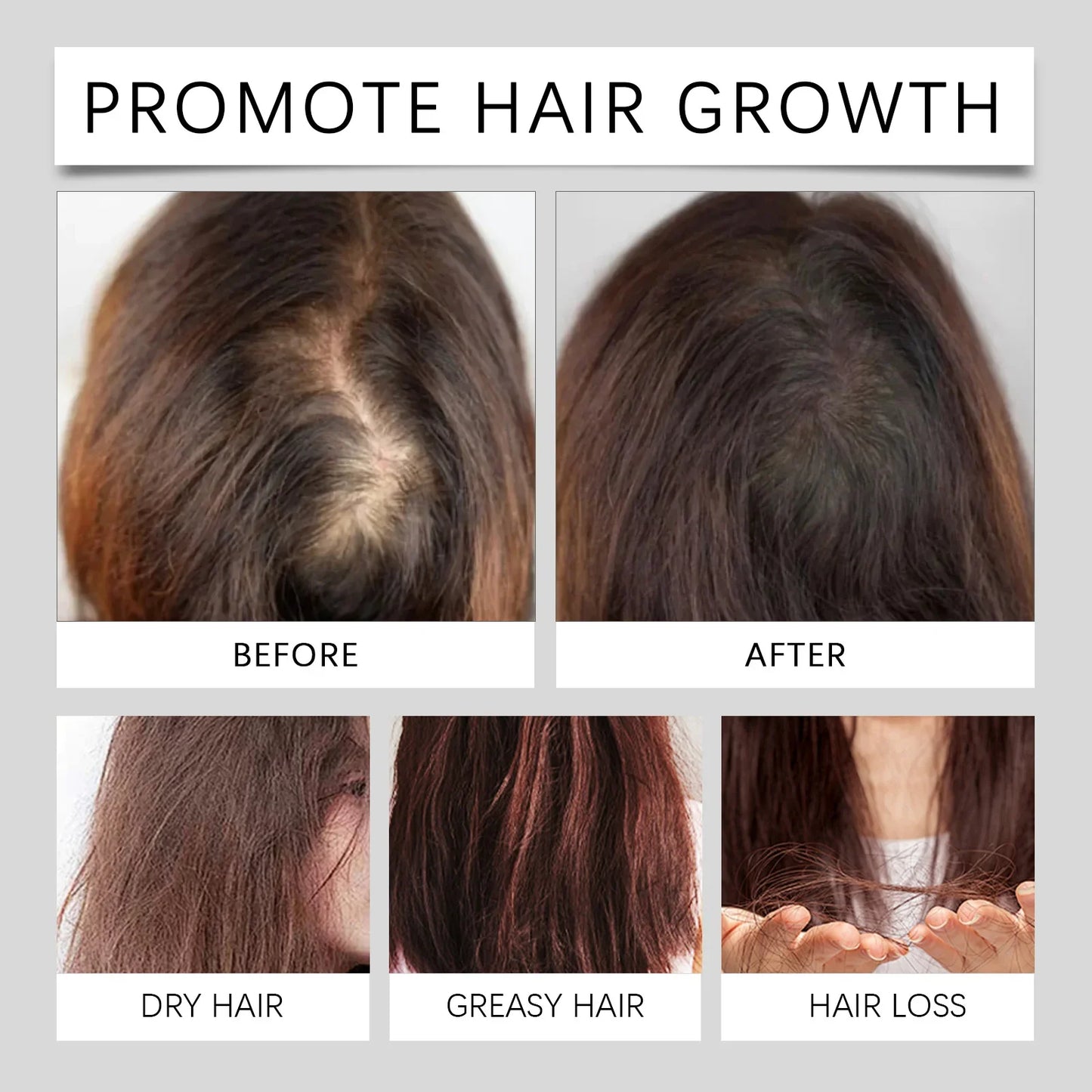 Natural Hair Growth Oil for Men and Women 60ml