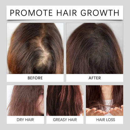 Natural Hair Growth Oil for Men and Women 60ml