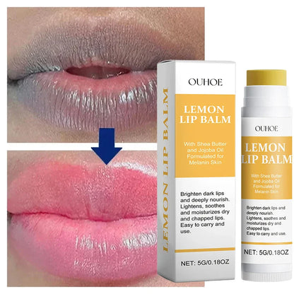 Aapon Mini Market Ltd OUHOE Lip Balm