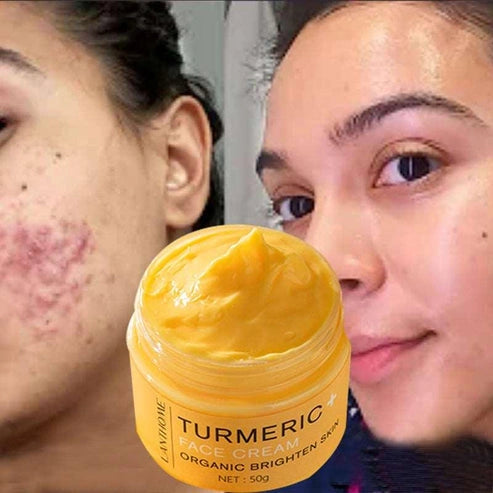 Aaponminimarket Radiant Glow Turmeric Cream