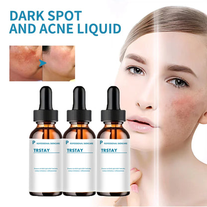 Retinol Serum Anti Wrinkle Facial Serum