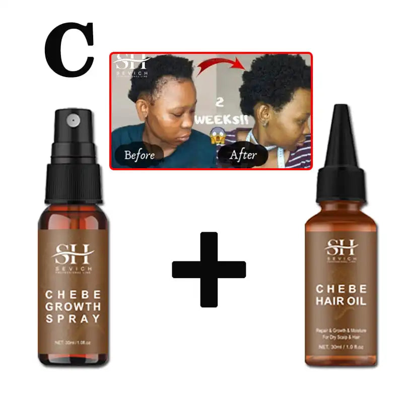 Sevich Chebe Hair Growth Spray