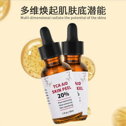 Aapon Mini Market Ltd TCA Skin Peel & Pore Minimizer