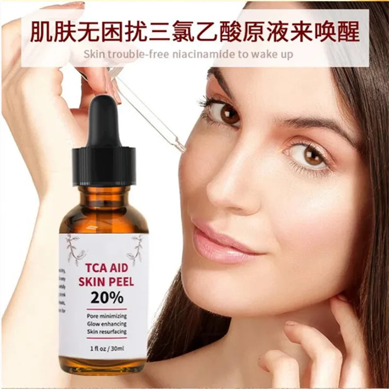 Aapon Mini Market Ltd TCA Skin Peel & Pore Minimizer