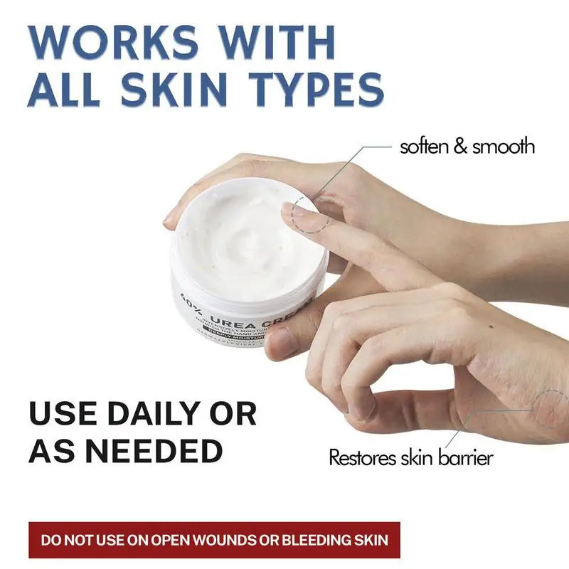 Aapon Mini Market Ltd - Urea Cream 40% for Hands and Feet 150g