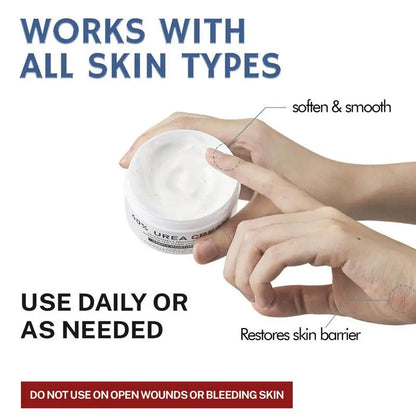 Aapon Mini Market Ltd - Urea Cream 40% for Hands and Feet 150g