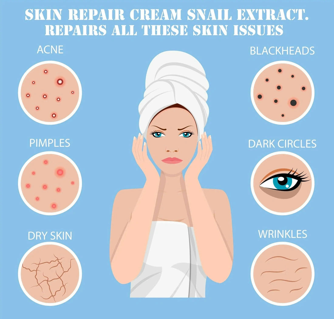 Ammuri Snail Extract Skin Cream for Deep Repair