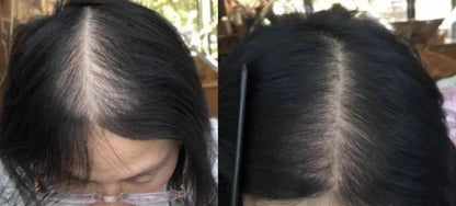 Lustrao Regrowth System