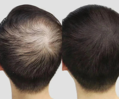 Lustrao Scalp Therapy Set