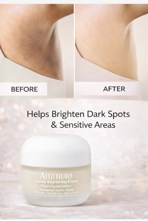 Ammuri Intense Brightening Cream Hyperpigmentation