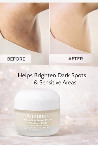 Ammuri Intense Brightening Cream Hyperpigmentation