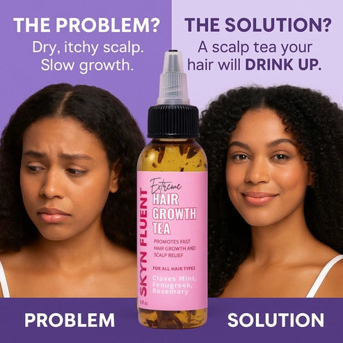 Extreme Hair Growth Tea | Herbal Scalp Treatment